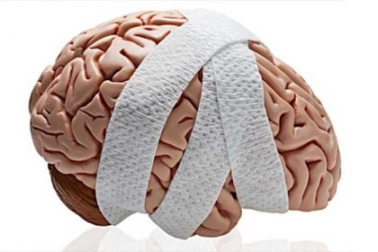 Daño cerebral