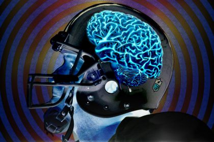 conmociones cerebrales causadas en la NFL